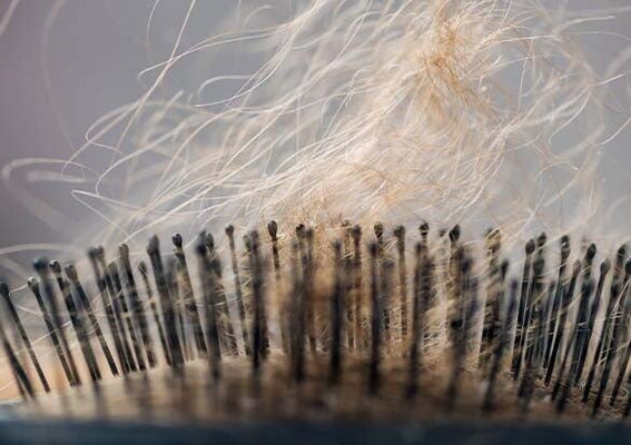 Hair loss causes: myths vs. facts and what you can do about it