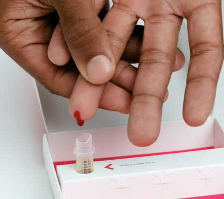 What causes blood sample errors?