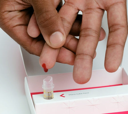 Why do blood samples clot? What it means and how to avoid it