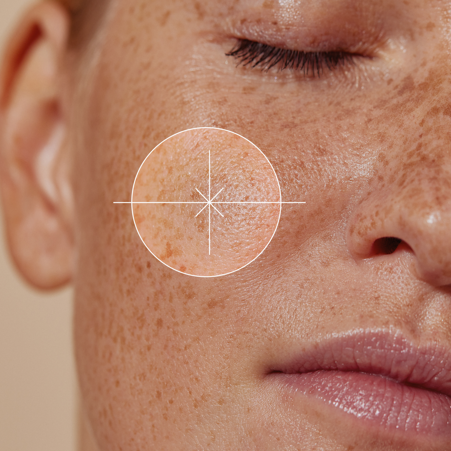 Close-up of a person's face with a focus on skin texture.