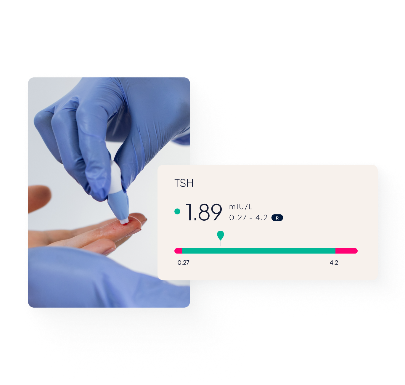 Close-up of a finger prick blood test being taken; a pop-up user interface tab depicting a TSH biomarker result.