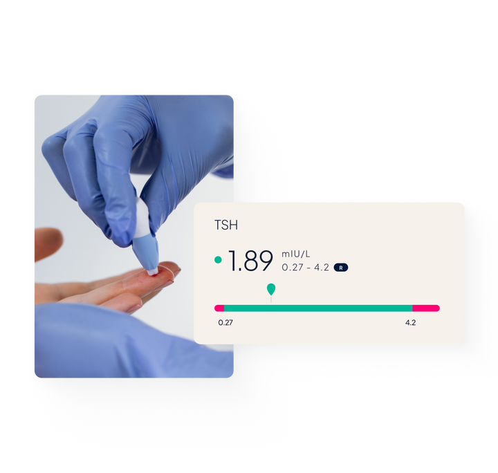 Close-up of a finger prick blood test being taken; a pop-up user interface tab depicting a TSH biomarker result.
