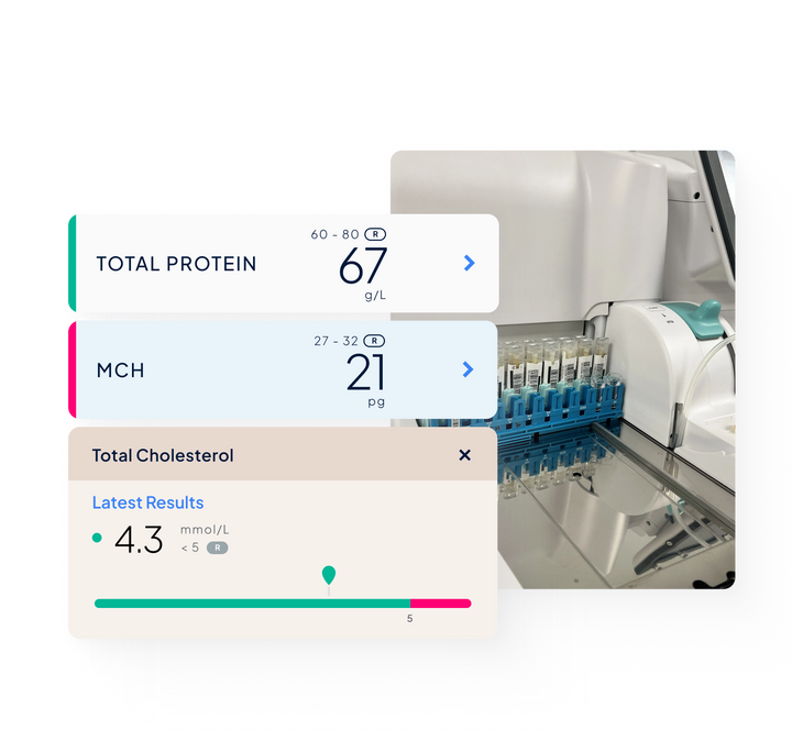 An image of lab equipment; 3 pop-ups depicting blood test results within MyMedichecks results platform.