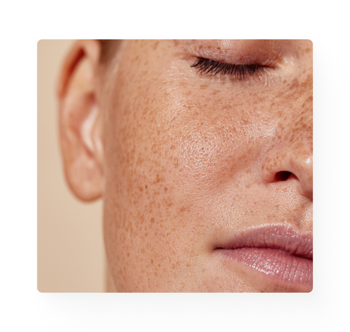 Close up image of a woman's glowy skin.